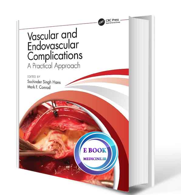 دانلود کتاب  Vascular and Endovascular Complications: A Practical Approach 2021 (ORIGINAL PDF)